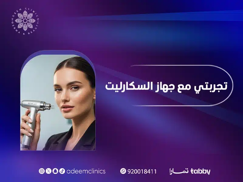 تجربتي مع جهاز السكارليت| ماذا أفعل بعد جلسة سكارليت؟