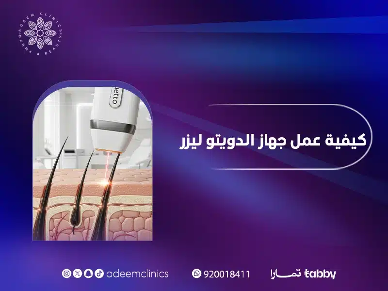 كيفية عمل جهاز الدويتو ليزر لإزالة الشعر : اسعار جلسات الدويتو باليرموك