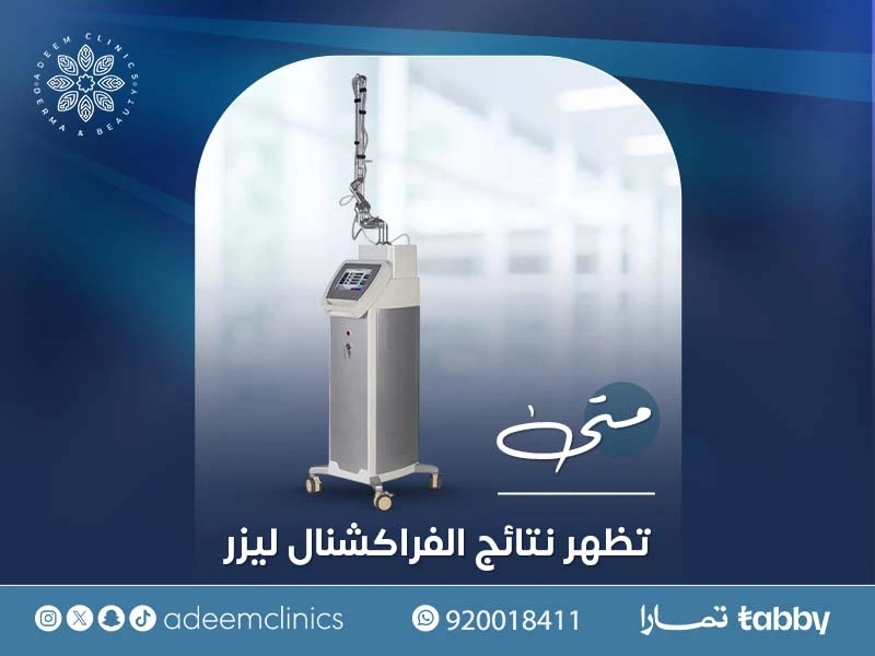 متى تظهر نتائج الفراكشنال ليزر للوجه؟خطوة بخطوة ومتى أقدر أن أتروش بعد الفراكشنال؟