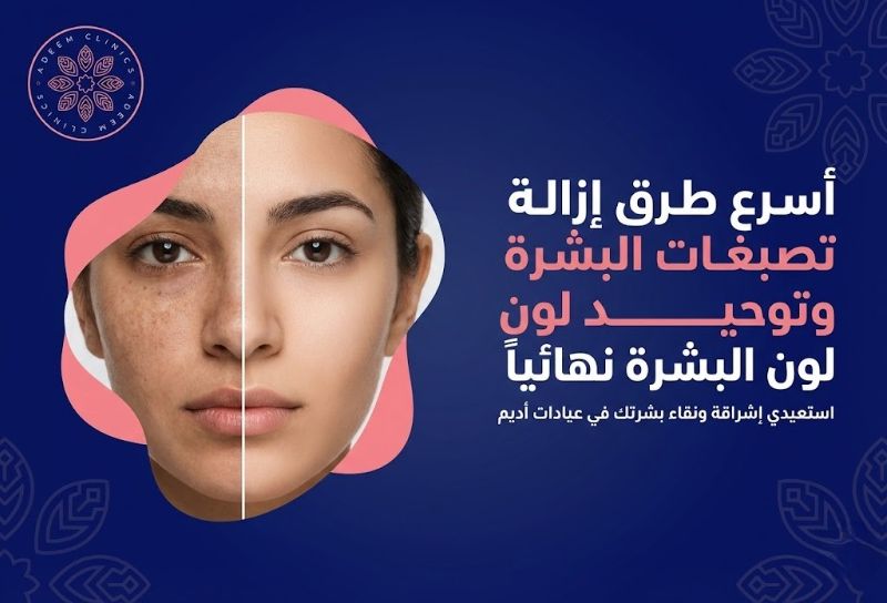 أسرع طرق ازالة تصبغات البشرة وتوحيد لون البشرة نهائياً