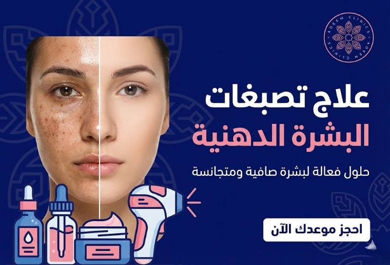 علاج تصبغات البشرة الدهنية/ ما هي أفضل الطرق لإزالة تصبغات الوجه نهائيًا؟