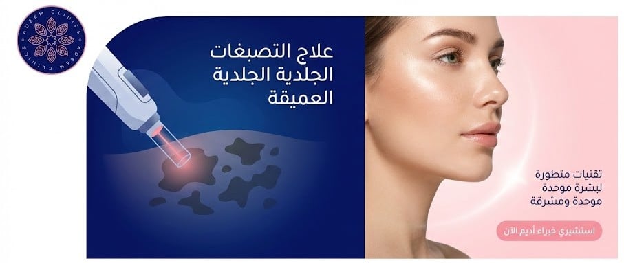 علاج التصبغات الجلدية العميقة