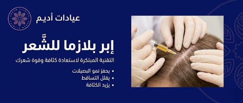 إبر بلازما الشعر PRP — افضل عيادة حقن بلازما شعر