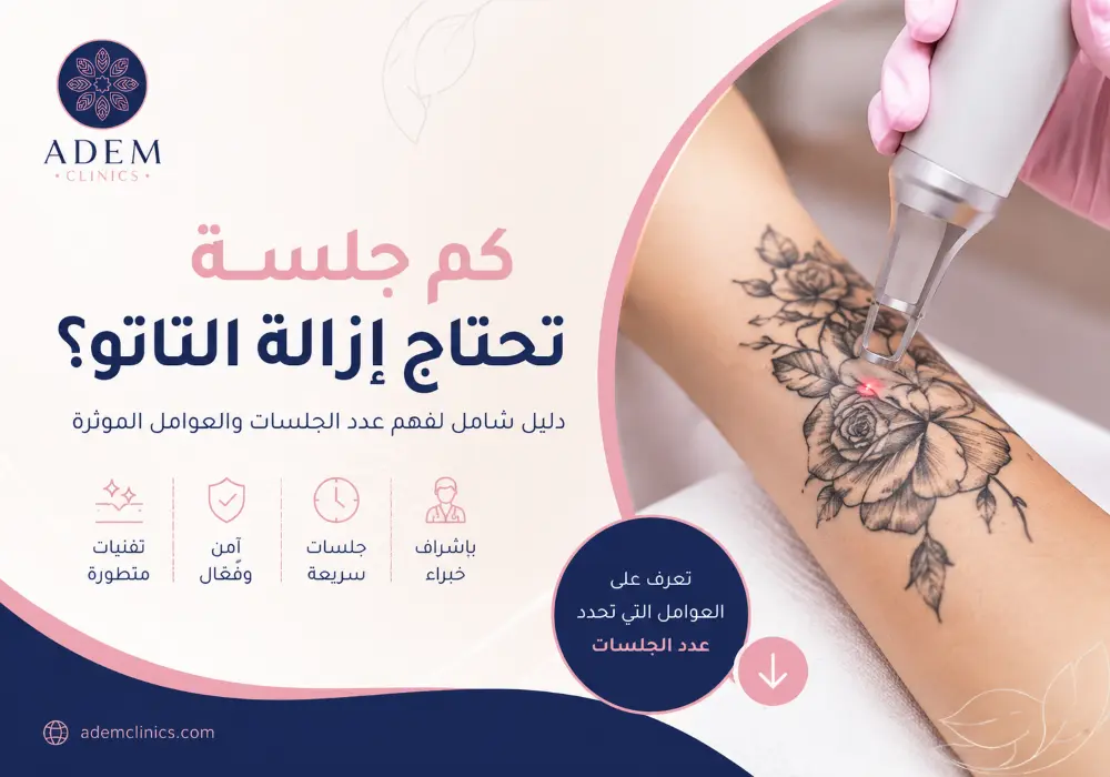 كم جلسه تحتاج ازالة التاتو